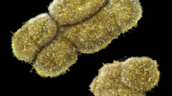 Male Human Sex Chromosomes X and Y SEM