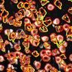An image of neurons (white) taken using calcium imaging techniques. An innovative software dubbed CaImAn can automatically differentiate between individual neurons (yellow outlines) with nearly the same accuracy as a human (red outlines).