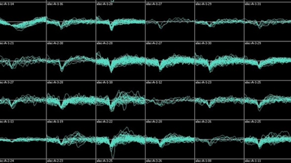 An 8x6 grid of black boxes, each representing different levels of brain functions