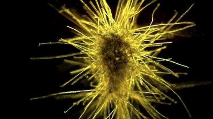 Up close view of Trichodesmium