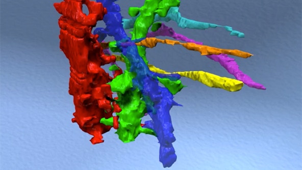 Part of a reconstructed fly medulla