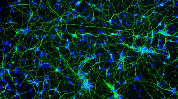 fluorescence light micrograph of human cortical neurons. These neurons (nerve cells) are from the outer layer (cortex) of the brain. The cell nuclei, which contain each cell’s genetic information in the form of DNA (deoxyribonucleic acid), are blue.