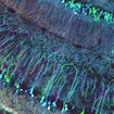 Confocal microscopy of mouse brain