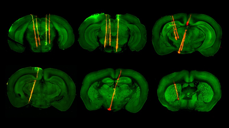 A view of a brain with green color showing the brain's anatomy while red dye shows the positions of Neuropixels probes.