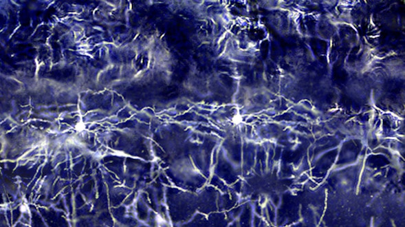 Purple-tinted neurons