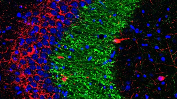 Link molecules, circuits and behavior to promote memory from Loren Frank