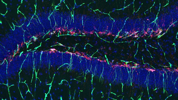 Hippocampus image