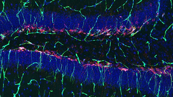 Villeda Hippocampus