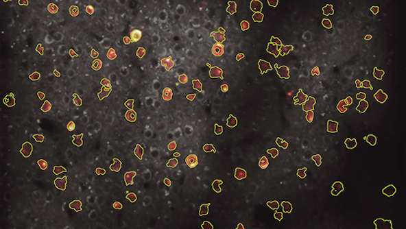 Automatic detection of neurons and neuronal processes contained in the data streams generated by brains of test subjects. Here, the pink and yellow objects are active neurons or neuronal processes detected in the brain of a mouse engaged in a behavioral task