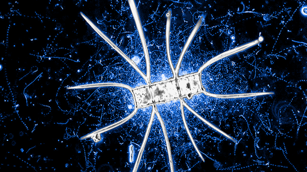 A microbial community around a marine diatom