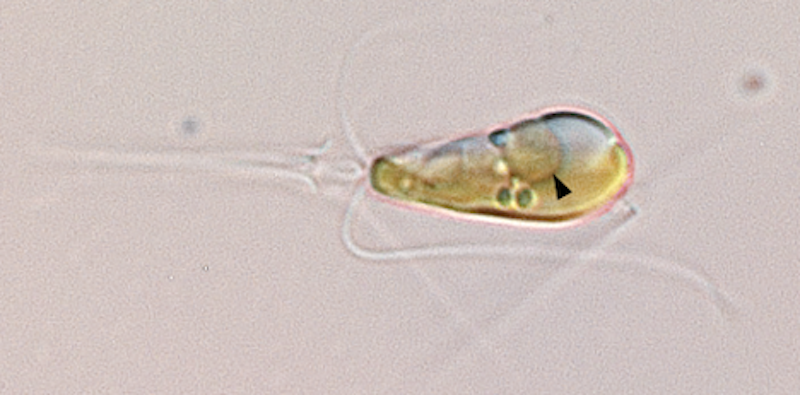 Nitroplast organelle.